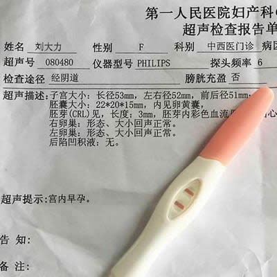 微信整人圖片之孕檢報告圖紙效果 微信整人圖片之孕檢報告圖紙效果